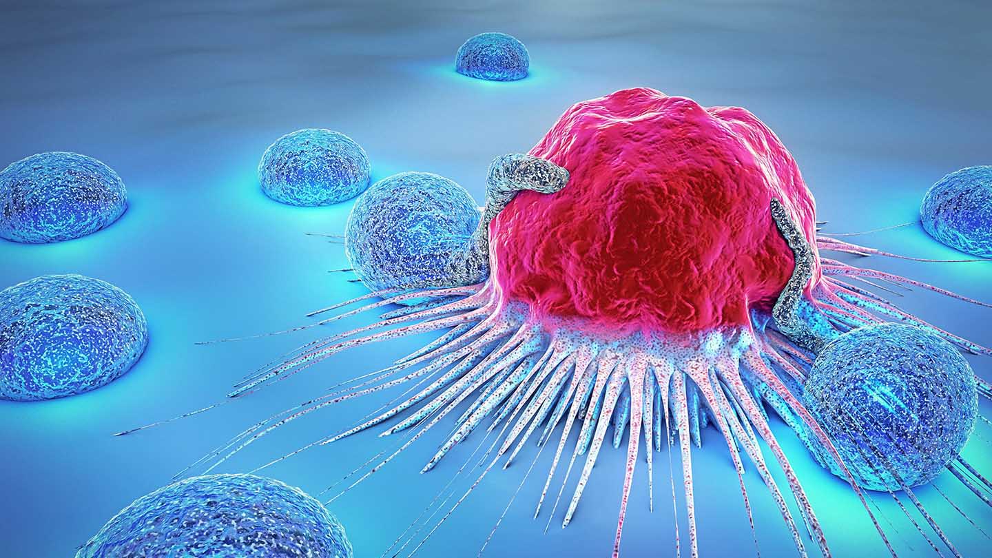 اهمیت تحقیق و بررسی کامل در خصوص مراحل و گزینه های درمانی سرطان